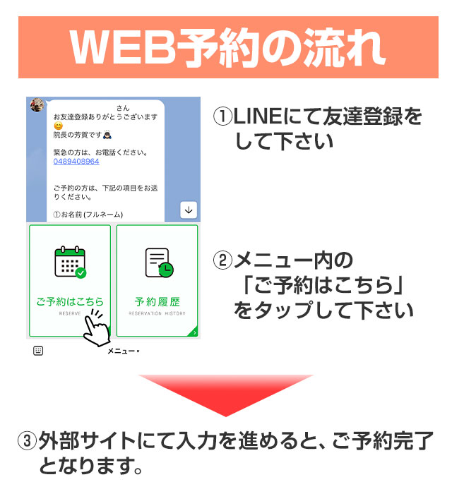WEB予約